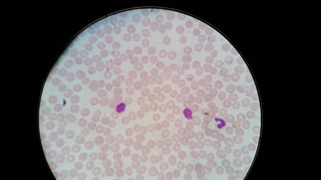 Blood Slides - Blood 006 400X